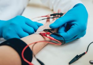 آزمایش الکتریکی هدایت عصبی