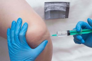 آزمایش تجزیه و تحلیل مایع سینوویال