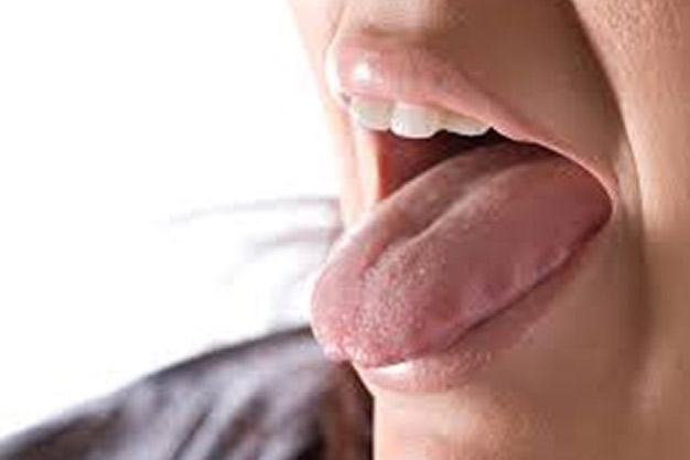 سندروم شوگرن