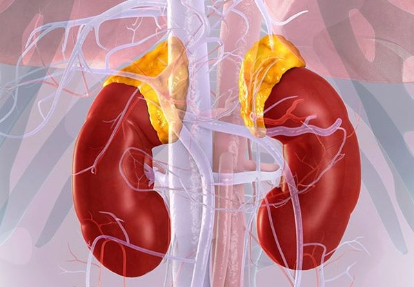 بیماری آدیسون (Addison's Disease)