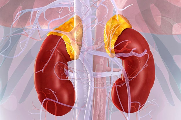 بیماری آدیسون (Addison's Disease)