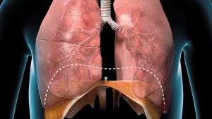 علل سندروم گودپاسچر (Goodpasture Syndrome)
