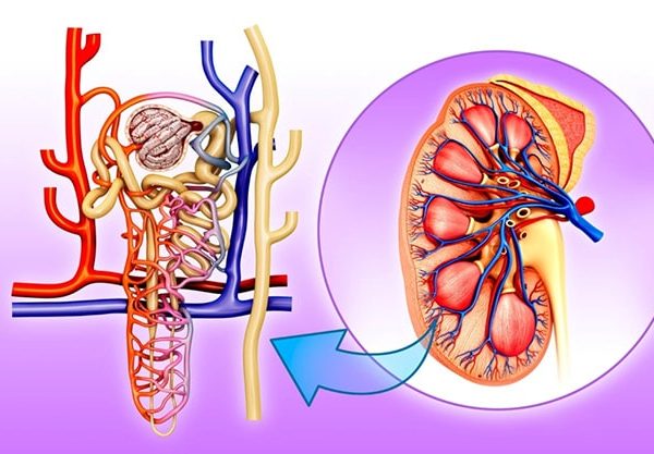 سندروم گودپاسچر (Goodpasture Syndrome)