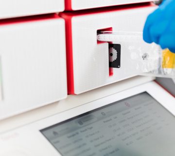 تست PCR برای عفونت مفصل