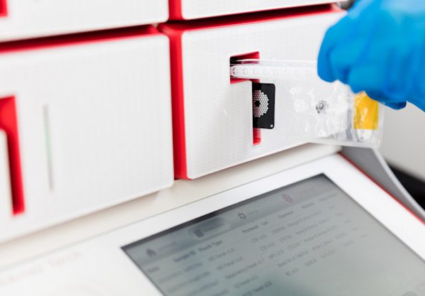 تست PCR برای عفونت مفصل